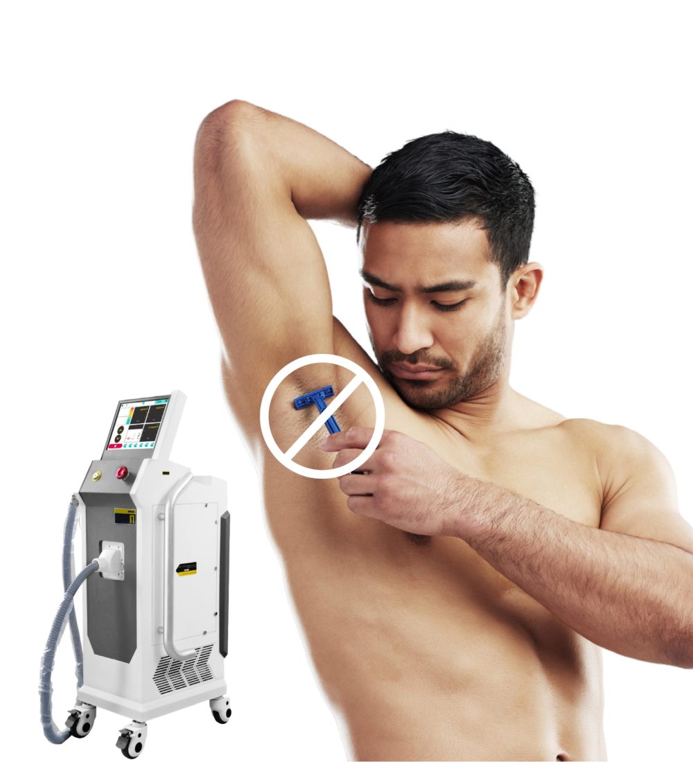 hair removal laser